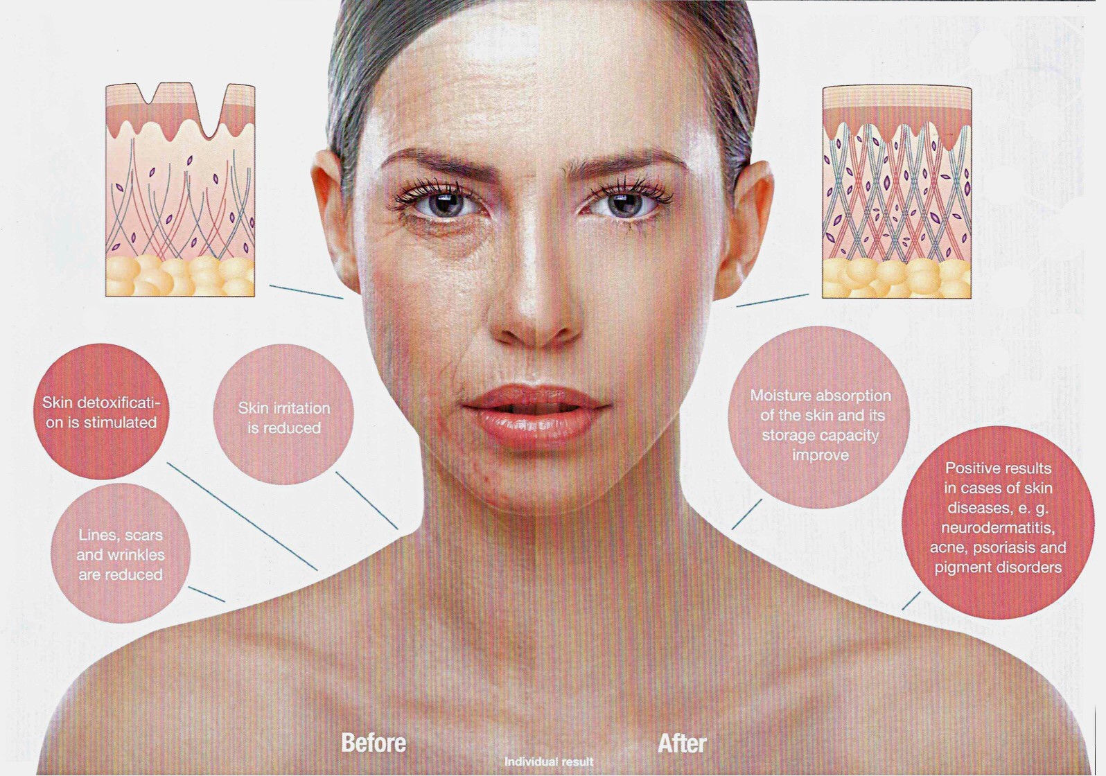 Collagen Light Therapy - Stay Young and Healthy.